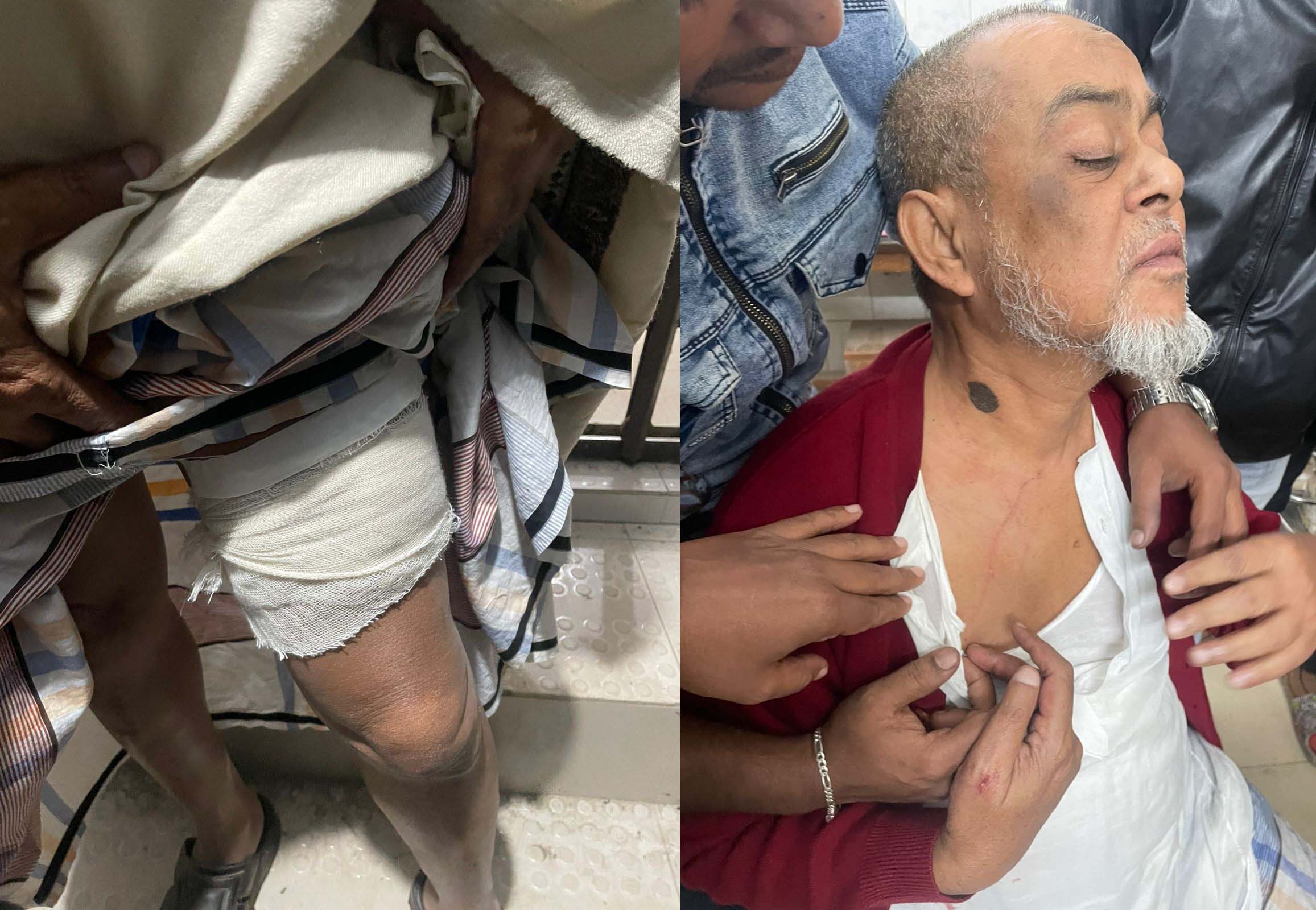 পৈত্রিক জমি নিয়ে বিরোধ বৃদ্ধকে পিস্তল ঠেকিয়ে হত্যার চেষ্টায় মামলা