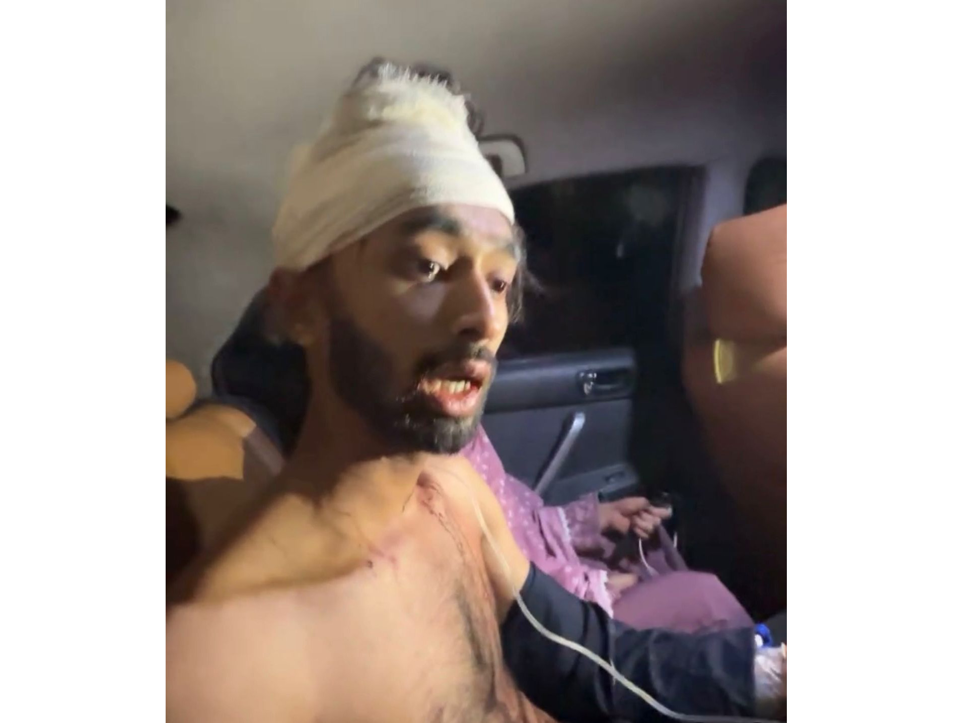 ছাত্রদল কর্মীকে কুপিয়ে জখম করার অভিযোগ